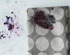 Berry Stains Are A Pain But We Just Found A Solution That Get Them Out Permanently; No Matter How Deep
