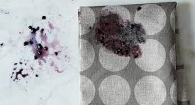 Berry Stains Are A Pain But We Just Found A Solution That Get Them Out Permanently; No Matter How Deep